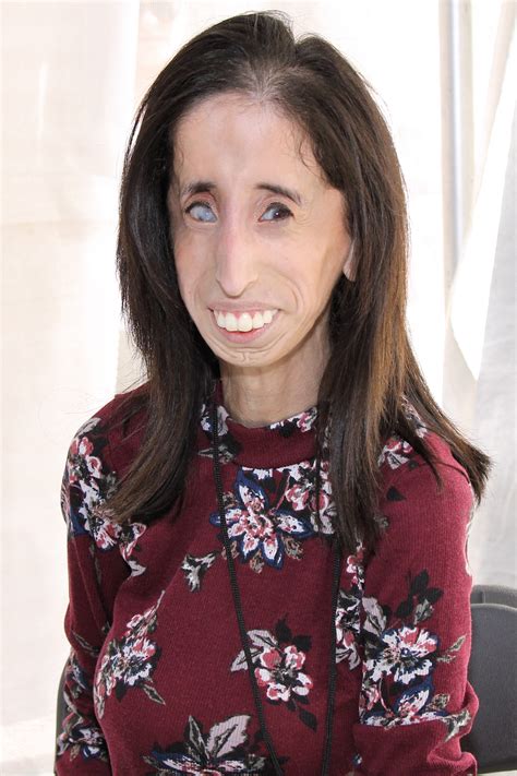 ugly black chick|Lizzie Velásquez .